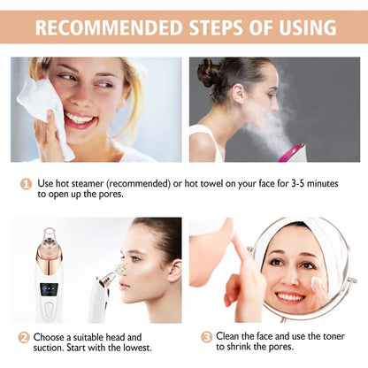 Orelle PorePro™ – Advanced Blackhead Vacuum